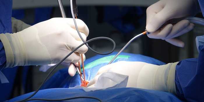 Transplante