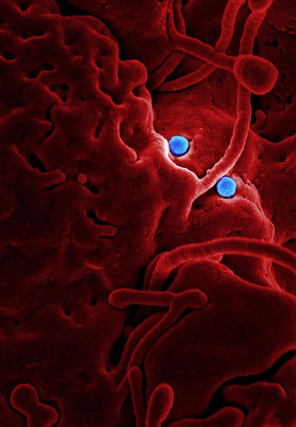 Coronavirus